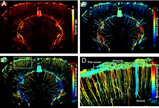 Figure 1 for Vascular Segmentation of Functional Ultrasound Images using Deep Learning