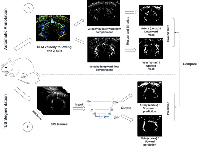 Figure 3 for Vascular Segmentation of Functional Ultrasound Images using Deep Learning