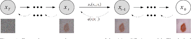 Figure 1 for FDiff-Fusion:Denoising diffusion fusion network based on fuzzy learning for 3D medical image segmentation