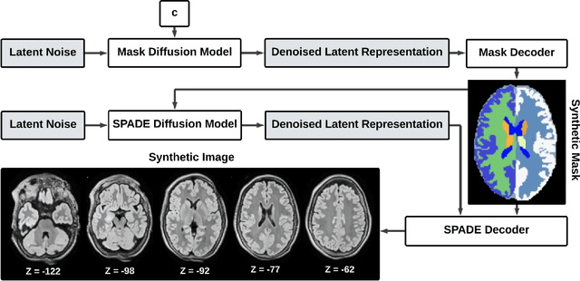 Figure 3 for Guided Synthesis of Labeled Brain MRI Data Using Latent Diffusion Models for Segmentation of Enlarged Ventricles