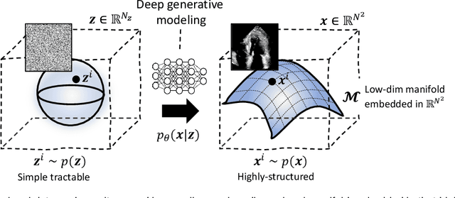 Figure 2 for Active inference and deep generative modeling for cognitive ultrasound