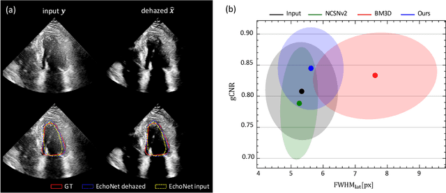 Figure 4 for Active inference and deep generative modeling for cognitive ultrasound