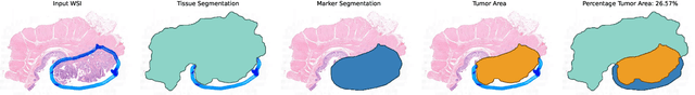 Figure 1 for "No negatives needed": weakly-supervised regression for interpretable tumor detection in whole-slide histopathology images