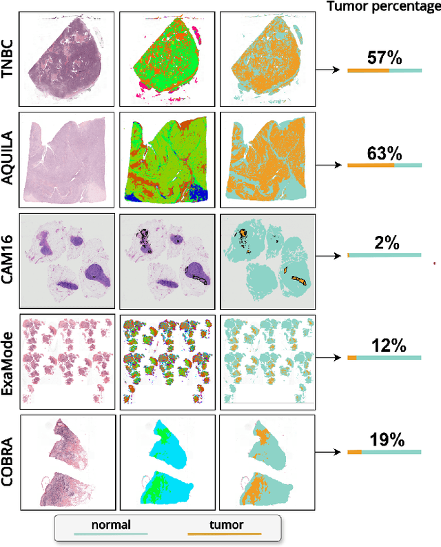 Figure 3 for "No negatives needed": weakly-supervised regression for interpretable tumor detection in whole-slide histopathology images