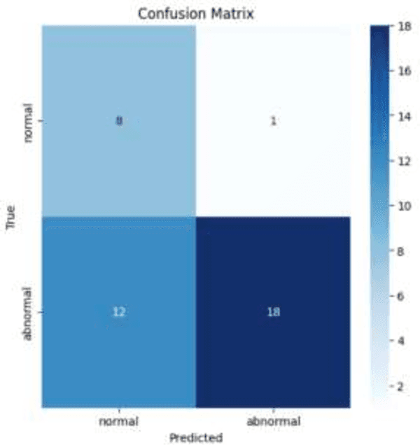 Figure 3 for AI Guided Early Screening of Cervical Cancer