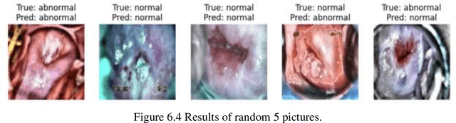 Figure 4 for AI Guided Early Screening of Cervical Cancer