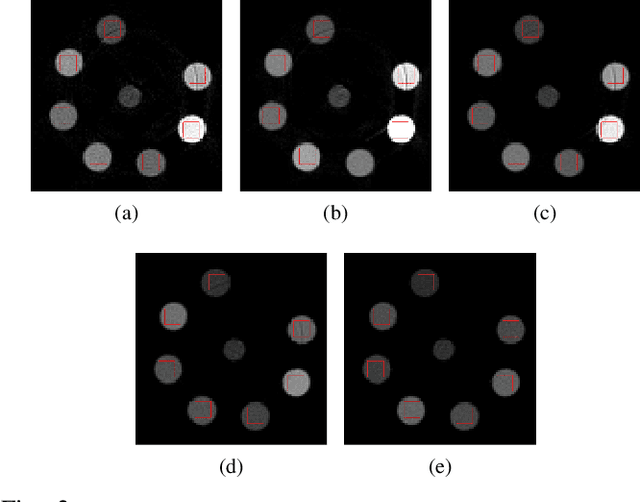 Figure 1 for Direct Iterative Reconstruction of Multiple Basis Material Images in Photon-counting Spectral CT