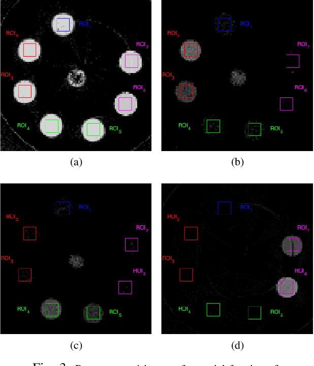 Figure 2 for Direct Iterative Reconstruction of Multiple Basis Material Images in Photon-counting Spectral CT