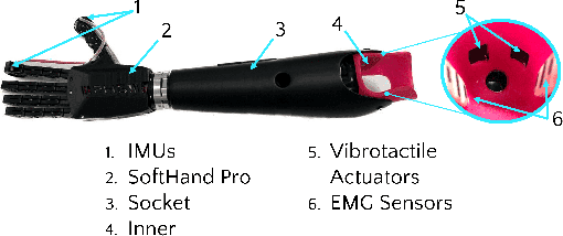 Figure 1 for Characterization, Experimental Validation and Pilot User Study of the Vibro-Inertial Bionic Enhancement System (VIBES)