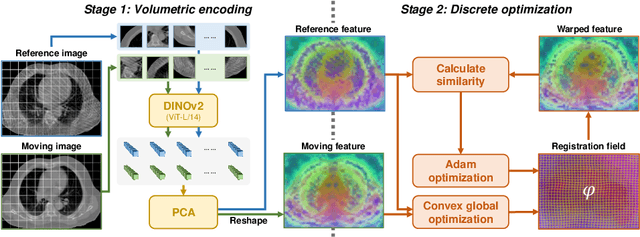 Figure 1 for General Purpose Image Encoder DINOv2 for Medical Image Registration