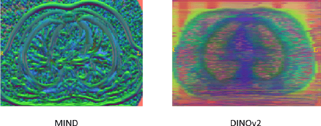 Figure 3 for General Purpose Image Encoder DINOv2 for Medical Image Registration