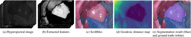 Figure 1 for Scribble-Based Interactive Segmentation of Medical Hyperspectral Images