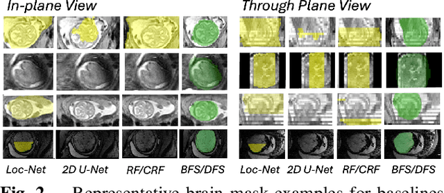 Figure 3 for Search Wide, Focus Deep: Automated Fetal Brain Extraction with Sparse Training Data