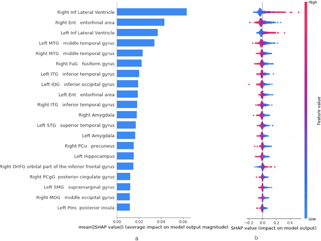 Figure 3 for A comprehensive interpretable machine learning framework for Mild Cognitive Impairment and Alzheimer's disease diagnosis