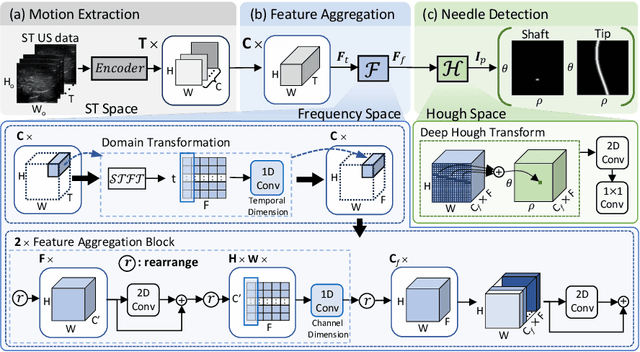 Figure 1 for Invisible Needle Detection in Ultrasound: Leveraging Mechanism-Induced Vibration