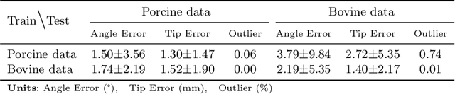 Figure 4 for Invisible Needle Detection in Ultrasound: Leveraging Mechanism-Induced Vibration