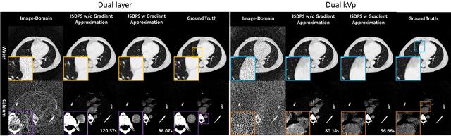 Figure 2 for CT Material Decomposition using Spectral Diffusion Posterior Sampling