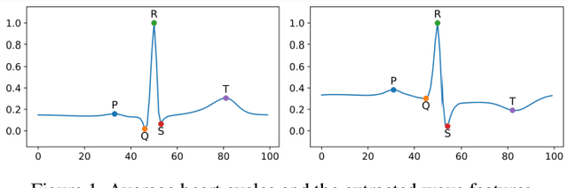 Figure 1 for Interpretable estimation of the risk of heart failure hospitalization from a 30-second electrocardiogram