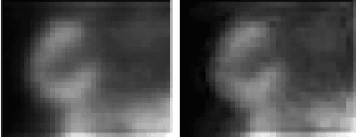 Figure 1 for Few-Shot Classification and Anatomical Localization of Tissues in SPECT Imaging