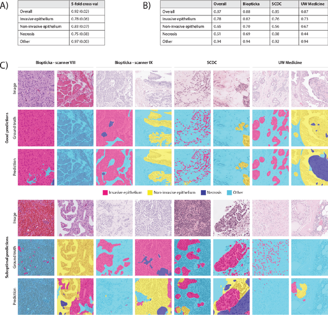 Figure 3 for A Multicentric Dataset for Training and Benchmarking Breast Cancer Segmentation in H&E Slides