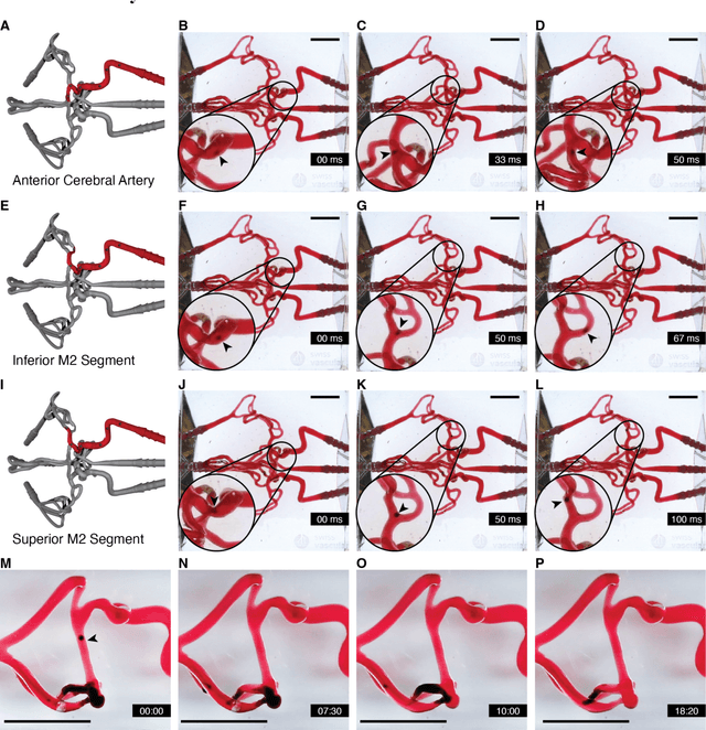 Figure 4 for Clinically Ready Magnetic Microrobots for Targeted Therapies