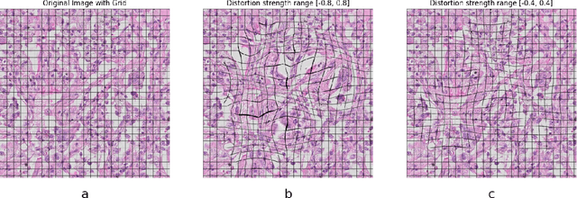 Figure 3 for Segmentation of Non-Small Cell Lung Carcinomas: Introducing DRU-Net and Multi-Lens Distortion