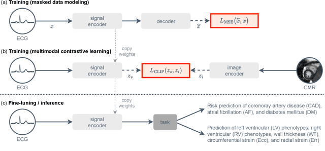 Figure 1 for Unlocking the Diagnostic Potential of ECG through Knowledge Transfer from Cardiac MRI