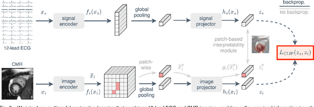 Figure 3 for Unlocking the Diagnostic Potential of ECG through Knowledge Transfer from Cardiac MRI