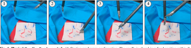 Figure 4 for SuFIA: Language-Guided Augmented Dexterity for Robotic Surgical Assistants