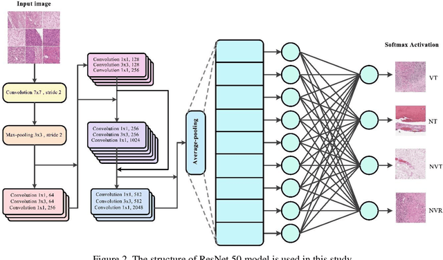 Figure 3 for Advanced Hybrid Deep Learning Model for Enhanced Classification of Osteosarcoma Histopathology Images