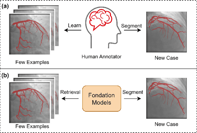 Figure 1 for Retrieval-augmented Few-shot Medical Image Segmentation with Foundation Models