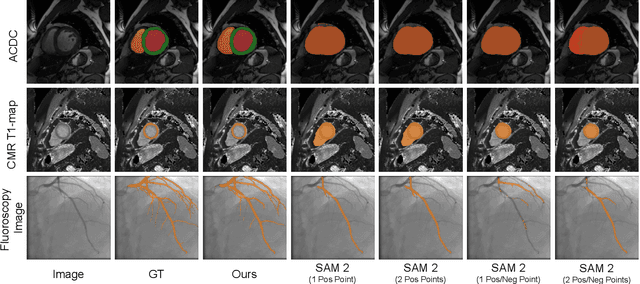 Figure 3 for Retrieval-augmented Few-shot Medical Image Segmentation with Foundation Models