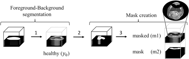 Figure 3 for Generating 3D Pseudo-Healthy Knee MR Images to Support Trochleoplasty Planning