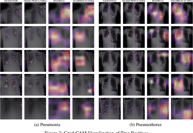 Figure 4 for From Competition to Collaboration: Making Toy Datasets on Kaggle Clinically Useful for Chest X-Ray Diagnosis Using Federated Learning