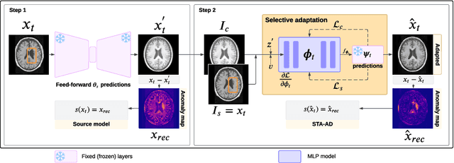 Figure 3 for Selective Test-Time Adaptation for Unsupervised Anomaly Detection using Neural Implicit Representations