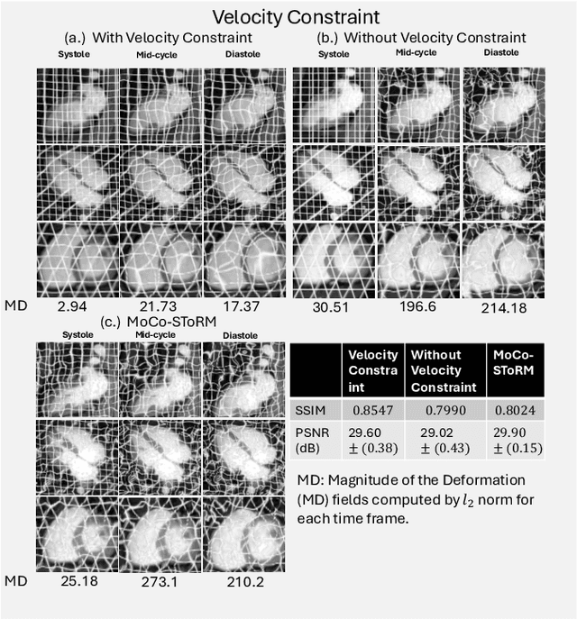 Figure 3 for Motion-compensated cardiac MRI using low-rank diffeomorphic flow (DMoCo)