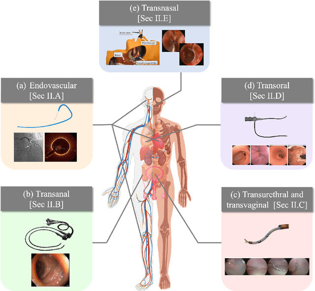 Figure 1 for Autonomous Navigation for Robot-assisted Intraluminal and Endovascular Procedures: A Systematic Review