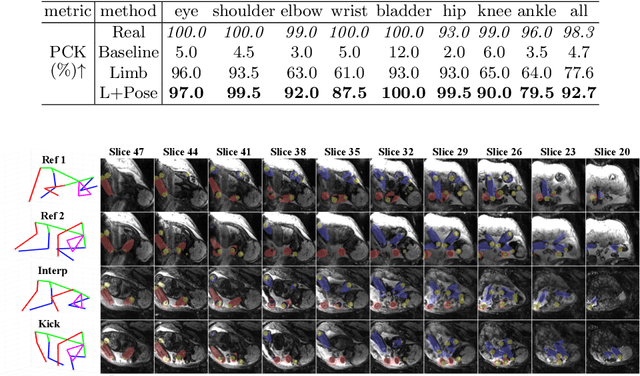 Figure 4 for FetalDiffusion: Pose-Controllable 3D Fetal MRI Synthesis with Conditional Diffusion Model