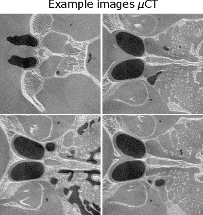 Figure 2 for Steerable Conditional Diffusion for Out-of-Distribution Adaptation in Imaging Inverse Problems