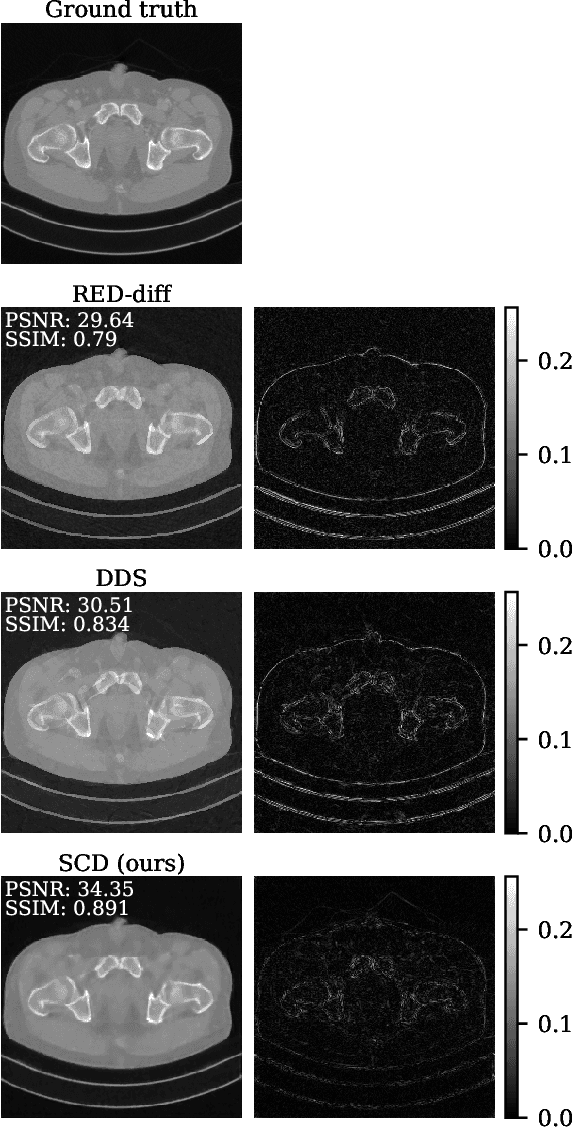 Figure 3 for Steerable Conditional Diffusion for Out-of-Distribution Adaptation in Imaging Inverse Problems