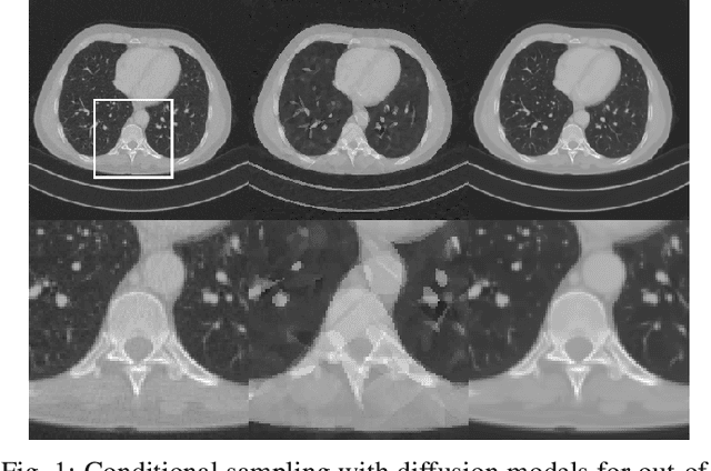 Figure 1 for Steerable Conditional Diffusion for Out-of-Distribution Adaptation in Imaging Inverse Problems