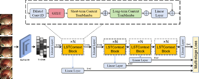 Figure 3 for SPRMamba: Surgical Phase Recognition for Endoscopic Submucosal Dissection with Mamba