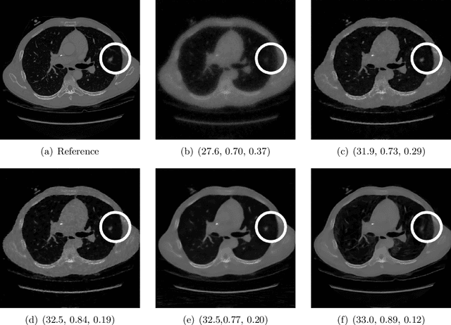 Figure 3 for A study of why we need to reassess full reference image quality assessment with medical images