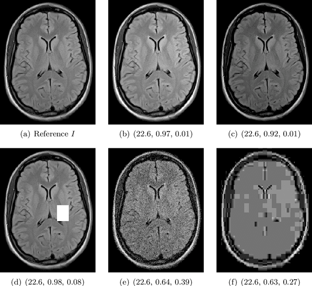 Figure 1 for A study of why we need to reassess full reference image quality assessment with medical images