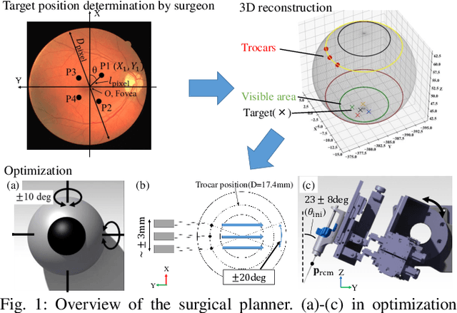 Figure 1 for Pre-Surgical Planner for Robot-Assisted Vitreoretinal Surgery: Integrating Eye Posture, Robot Position and Insertion Point