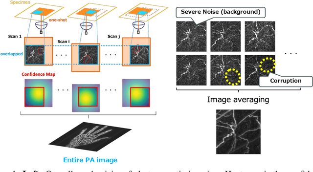 Figure 1 for Guidance-base Diffusion Models for Improving Photoacoustic Image Quality