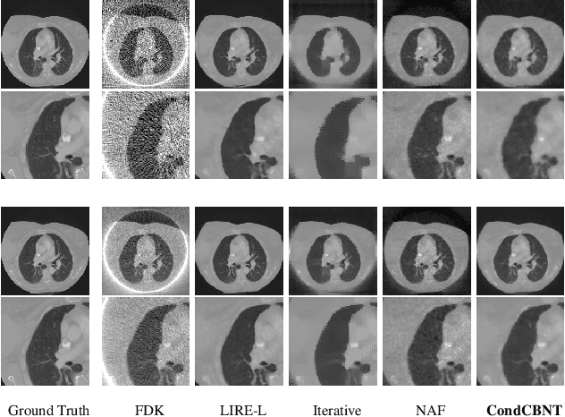 Figure 3 for Neural Modulation Fields for Conditional Cone Beam Neural Tomography