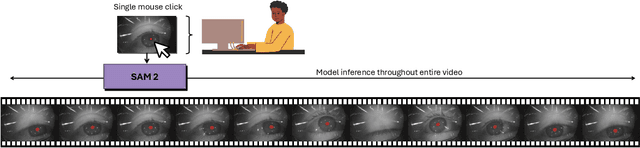 Figure 1 for Zero-Shot Pupil Segmentation with SAM 2: A Case Study of Over 14 Million Images