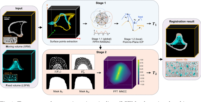 Figure 1 for Reference-Free Multi-Modality Volume Registration of X-Ray Microscopy and Light-Sheet Fluorescence Microscopy