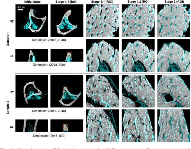 Figure 3 for Reference-Free Multi-Modality Volume Registration of X-Ray Microscopy and Light-Sheet Fluorescence Microscopy